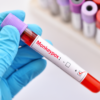 lab tube with monkeypox label