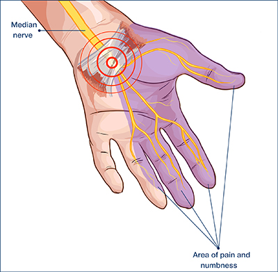 carpal tunnel anatomy 